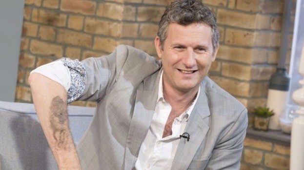 Australian comedian Adam Hills: I was born without a foot